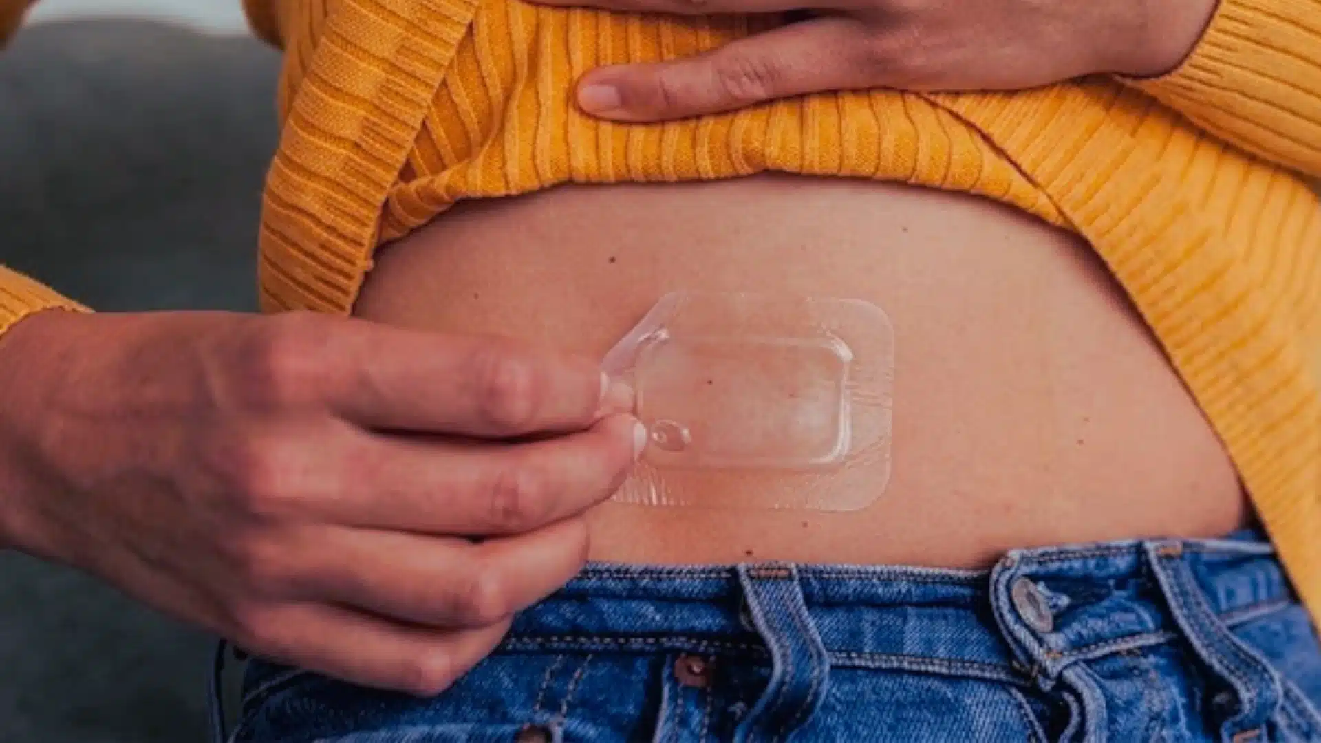 estrogen patch placement
