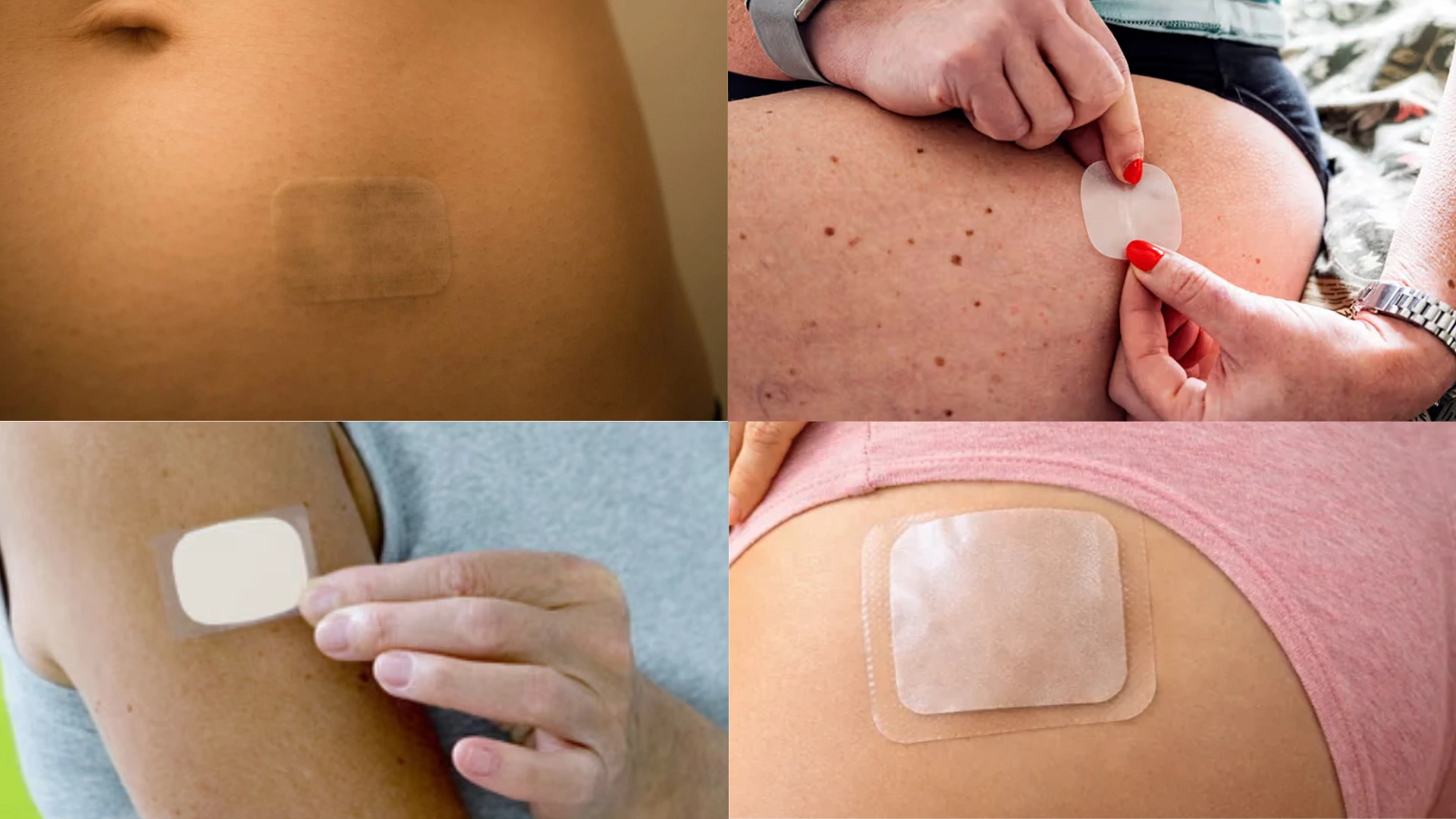 where to put estrogen patch
